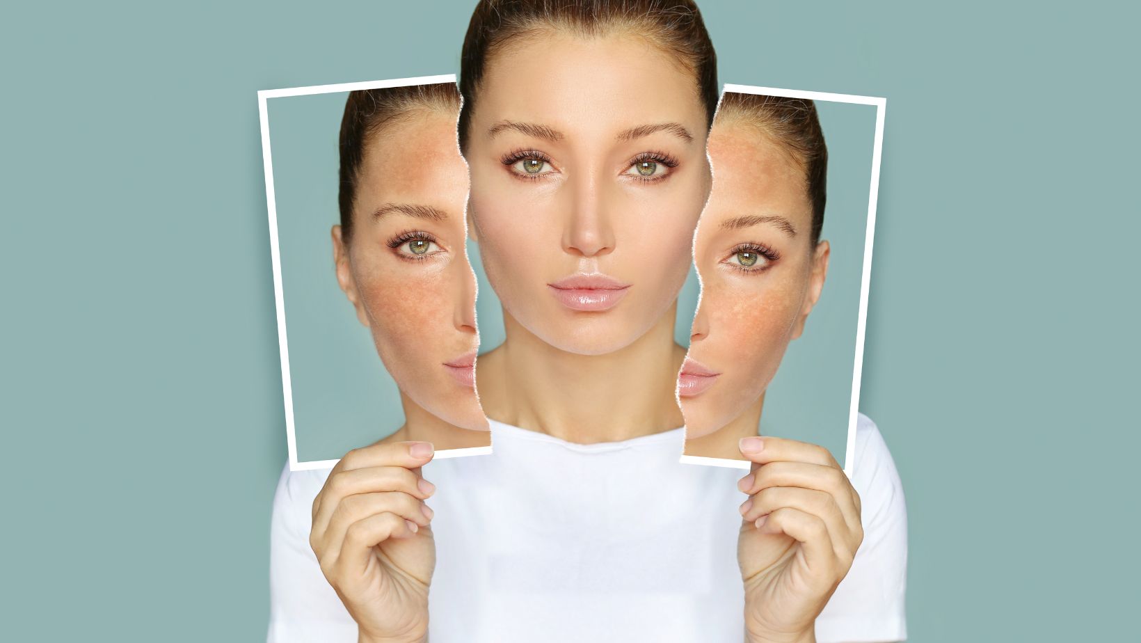 6 Common Skin Problems Laser Treatments Can Solve